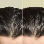 Banology 2 in 1 Scalp Scrub & Shampoo