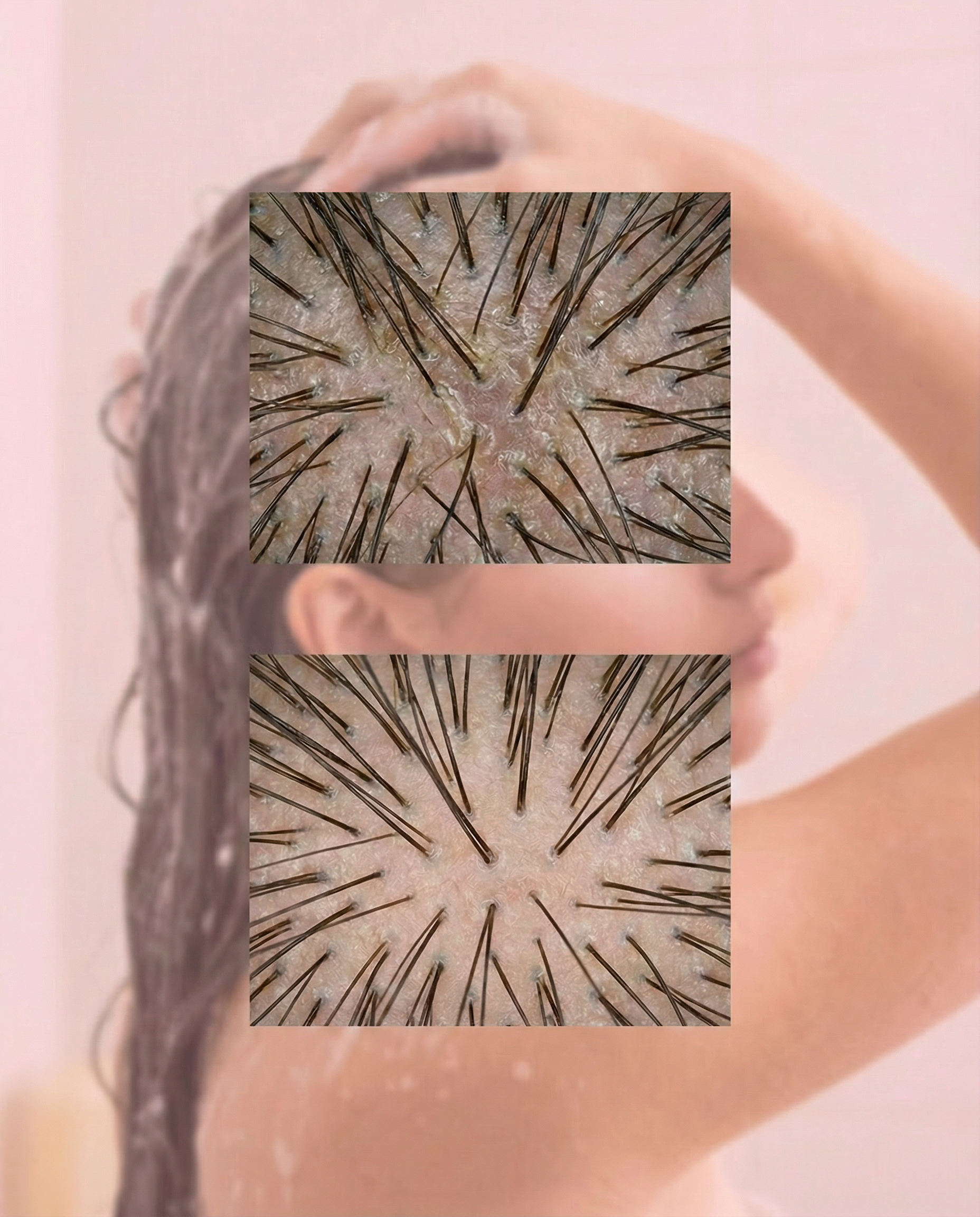 Banology 2 in 1 Scalp Scrub & Shampoo